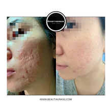 Load image into Gallery viewer, COLLEET GLOW - LT+ Beauty supplement