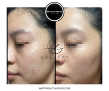 Load image into Gallery viewer, COLLEET GLOW - LT+ Beauty supplement