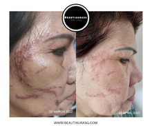 Load image into Gallery viewer, COLLEET GLOW - LT+ Beauty supplement