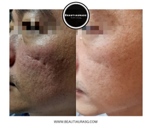 Load image into Gallery viewer, COLLEET GLOW - LT+ Beauty supplement