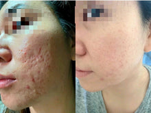 Load image into Gallery viewer, COLLEET GLOW - LT+ Beauty supplement